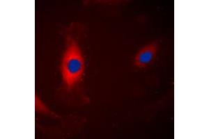 Immunofluorescent analysis of ERK1 staining in A431 cells.