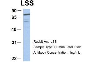 Host:  Rabbit  Target Name:  RIOK3  Sample Type:  Human Fetal Heart  Antibody Dilution:  1. (RIOK3 anticorps  (C-Term))