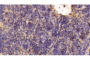 Detection of TIGIT in Mouse Spleen Tissue using Polyclonal Antibody to T-Cell Immunoreceptor With Ig And ITIM Domains Protein (TIGIT) (TIGIT anticorps  (AA 28-246))