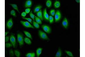 Immunofluorescence staining of A549 cells with ABIN7174093 at 1:100, counter-stained with DAPI. (PTPN13 anticorps  (AA 1965-2173))