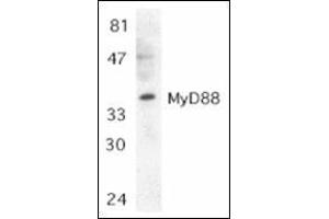 Western blot analysis of MyD88 in Jurkat whole cell lysate with this product at 1:500 dilution. (MYD88 anticorps  (C-Term))