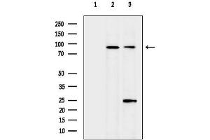 anti-Megakaryoblastic Leukemia (Translocation) 1 (MKL1) (N-Term) antibody