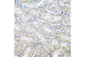 Immunohistochemistry of paraffin-embedded mouse kidney using TARS antibody at dilution of 1:100 (x40 lens). (TARS anticorps)