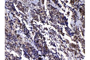 IHC analysis of Ran using anti-Ran antibody .