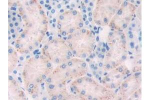 DAB staining on IHC-P; Samples: Rat Kidney Tissue (FLT1 anticorps  (AA 303-524))