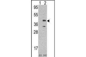 Western blot analysis of MVK (arrow) using rabbit polyclonal MVK Antibody (N-term) (ABIN392802 and ABIN2842240). (MVP anticorps  (N-Term))
