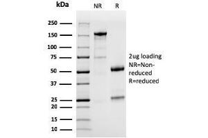 SDS-PAGE Analysis of Purified PD-L1 Mouse Monoclonal Antibody (PDL1/2746).