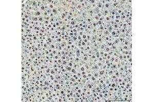 IHC analysis of DCK using anti-DCK antibody (ABIN5693016). (DCK anticorps  (AA 17-260))