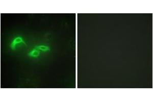 Immunofluorescence analysis of HepG2 cells, using TFAM Antibody. (TFAM anticorps  (AA 131-180))