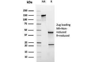 SDS-PAGE Analysis Purified CK20 Mouse Monoclonal Antibody (KRT20/3145). (KRT20 anticorps  (AA 196-323))