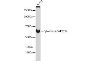 Western blot analysis of extracts of A-431 cells, using Cytokeratin 5 (KRT5) (KRT5) Rabbit mAb (ABIN7268103) at 1:1000 dilution. (Cytokeratin 5 anticorps)