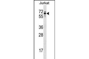 TROVE2 Antibody (C-term) (ABIN1537371 and ABIN2848873) western blot analysis in Jurkat cell line lysates (35 μg/lane). (TROVE2 anticorps  (C-Term))