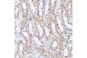 Immunohistochemistry of paraffin-embedded rat kidney using MTHFD2 antibody (ABIN6132367, ABIN6144144, ABIN6144145 and ABIN6214625) at dilution of 1:100 (40x lens).