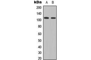 Western blot analysis of STAT2 (pY690) expression in HeLa (A), K562 (B) whole cell lysates. (STAT2 anticorps  (C-Term, pTyr690))