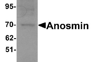 Western blot analysis of Anosmin in MCF7 cell lysate with Anosmin antibody at 1 µg/mL. (Anosmin anticorps  (Middle Region))