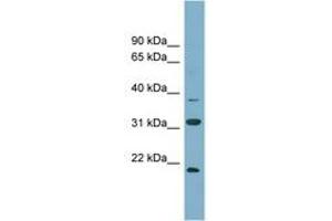 Image no. 1 for anti-N-6 Adenine-Specific DNA Methyltransferase 1 (Putative) (N6AMT1) (N-Term) antibody (ABIN6743395) (N6AMT1 anticorps  (N-Term))