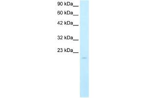 Western Blot showing SP140 antibody used at a concentration of 5. (SP140 anticorps  (N-Term))