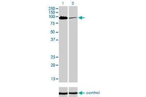 Western blot analysis of MCC over-expressed 293 cell line, cotransfected with MCC Validated Chimera RNAi (Lane 2) or non-transfected control (Lane 1). (MCC anticorps  (AA 31-130))