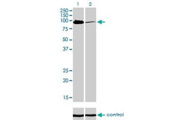 MCC anticorps  (AA 31-130)