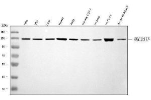 Western blot analysis of SEC23IP using anti-SEC23IP antibody (ABIN7601222).