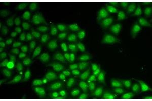 Immunofluorescence analysis of A549 cells using FEN1 Polyclonal Antibody