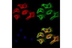 ABIN6266092 and ABIN6273027 staining Hela cells by IF/ICC.