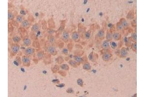MUC1 anticorps  (AA 410-525)