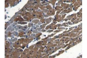 IHC-P analysis of Rat Heart Tissue, with DAB staining. (NCOA3 anticorps  (AA 1-269))