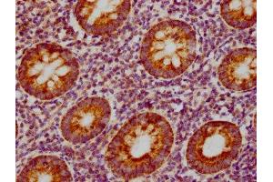 IHC image of ABIN7127388 diluted at 1:155 and staining in paraffin-embedded human appendix tissue performed on a Leica BondTM system. (Recombinant CCL19 anticorps)
