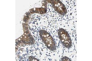 Immunohistochemical staining of human colon with TJP2 polyclonal antibody  shows moderate cytoplasmic and membranous positivity in glandular cells at 1:50-1:200 dilution.