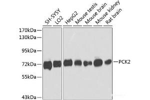 Western blot analysis of extracts of various cell lines using PCK2 Polyclonal Antibody at dilution of 1:1000. (PEPCK anticorps)