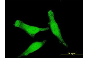 Immunofluorescence of monoclonal antibody to SMAD7 on HeLa cell. (SMAD7 anticorps  (AA 160-260))