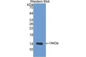 Western Blotting (WB) image for anti-V-Set Domain Containing T Cell Activation Inhibitor 1 (VTCN1) (AA 34-147) antibody (ABIN1176799)