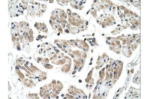 Immunohistochemistry (IHC) image for anti-Carbohydrate (Keratan Sulfate Gal-6) Sulfotransferase 1 (CHST1) (N-Term) antibody (ABIN2782241)