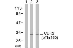 Western blot analysis of extracts from A2780 cells (Lane 1 and 2) and MDA-MB-435 cells (Lane 3), using CDK2 (phospho-Thr160) antibody (E011133). (CDK2 anticorps  (pThr160))