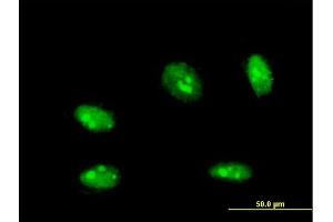 Immunofluorescence of monoclonal antibody to NANOG on HeLa cell. (Nanog anticorps  (AA 98-195))