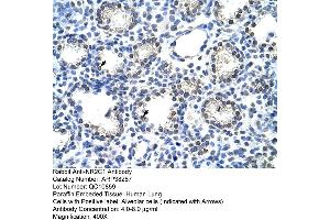 Human Lung (NR2C1 anticorps  (C-Term))
