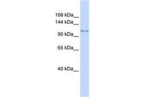 Image no. 1 for anti-Jumonji C Domain-Containing Histone Demethylase 1 Homolog D (JHDM1D) (AA 288-337) antibody (ABIN6744253) (JHDM1D anticorps  (AA 288-337))