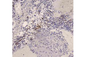 IHC analysis of DC-SIGN using anti-DC-SIGN antibody . (DC-SIGN/CD209 anticorps)