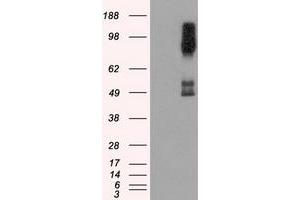 Image no. 4 for anti-B-Raf proto-oncogene, serine/threonine kinase (BRAF) antibody (ABIN1496952) (BRAF anticorps)
