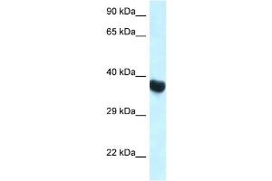 WB Suggested Anti-Hoxa10 Antibody Titration: 1. (HOXA10 anticorps  (C-Term))