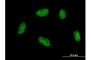 Immunofluorescence of monoclonal antibody to ATOH1 on HeLa cell. (ATOH1 anticorps  (AA 266-354))