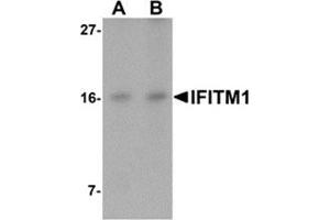 Western blot analysis of IFITM1 in Jurkat cell lysate with IFITM1 antibody at (A) 2. (IFITM1 anticorps  (C-Term))