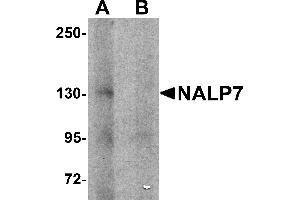 Western Blotting (WB) image for anti-NLR Family, Pyrin Domain Containing 7 (NLRP7) (N-Term) antibody (ABIN1031472) (NLRP7 anticorps  (N-Term))