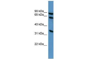 WB Suggested Anti-ELMO1 Antibody Titration: 0. (ELMO1 anticorps  (C-Term))