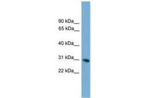 Image no. 1 for anti-Ficolin (Collagen/fibrinogen Domain Containing) 1 (FCN1) (AA 215-264) antibody (ABIN6745636) (FCN1 anticorps  (AA 215-264))