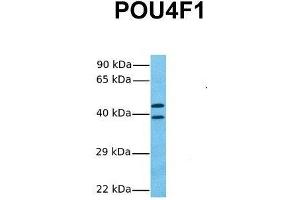 Host:  Rabbit  Target Name:  POU4F1  Sample Tissue:  Human Fetal Lung  Antibody Dilution:  1. (POU4F1 anticorps  (C-Term))