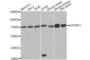 Western blot analysis of extracts of various cell lines, using IGF2BP1 antibody (ABIN1873165) at 1:1000 dilution. (IGF2BP1 anticorps)