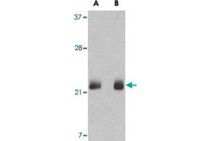 Western blot analysis of FGF4 in NIH NIH/3T3 cell lysate with FGF4 polyclonal antibody  at (A) 0. (FGF4 anticorps  (C-Term))
