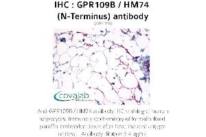 Image no. 2 for anti-Hydroxycarboxylic Acid Receptor 3 (HCAR3) (Extracellular Domain), (N-Term) antibody (ABIN1734901) (GPR109B anticorps  (Extracellular Domain, N-Term))